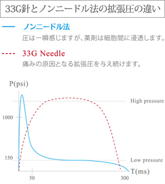 33G針とMEDJETの拡張圧の違い