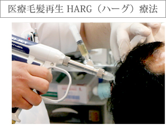 医療毛髪再生 HARG（ハーグ）療法