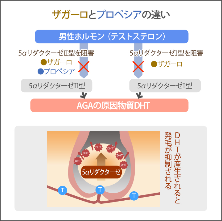 ザガーロとプロペシアの違い